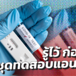 แนะ 5 สิ่งต้องเข้าใจ ก่อนใช้ชุดทดสอบแอนติเจน ด้วยตัวเอง