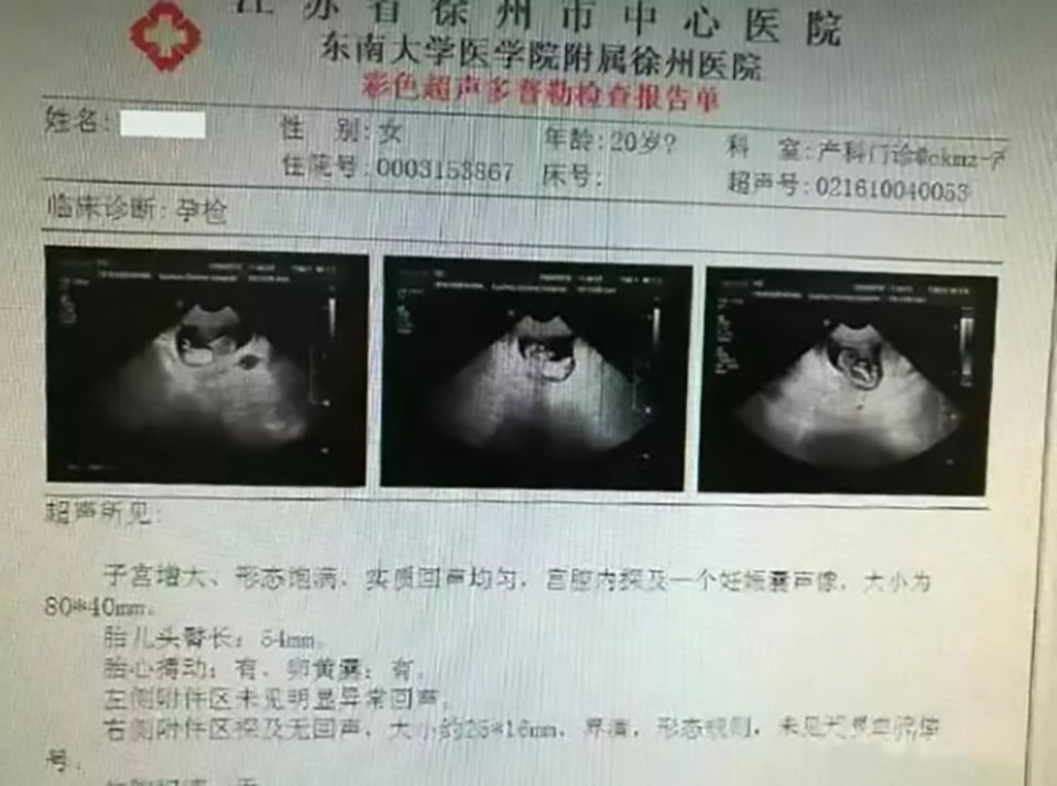Pic shows: The girls pregnancy test; A man who took his pregnant wife to hospital for a check-up was detained by police after the "woman" was found to be no older than 12. The girl, unnamed in reports, was accompanied the 40-year-old man and another woman who claimed to be her mother-in-law. The trio arrived at the Xuzhou City Central Hospital, in East Chinas Jiangsu Province, claiming that the girl was 12 weeks pregnant and that she needed a routine test to confirm that her foetus was healthy. The husband and mother-in-law said the wife was 20 years of age, but medics immediately alerted local authorities when they found the young patient to be more like a schoolgirl than a "woman". Doctors who tried to question the girl were unable to get any answers from her, as she did not speak any Mandarin. One of the staff said: "Its obvious she is just a child, not 20 years old." Their suspicion is also said to have angered the husband, who was quoted as saying: "I took her here to be examined - just do your job. Stop asking so many questions." Arriving police officers found that the girl did not possess a Chinese ID and concluded that she was a foreign national from Southeast Asia, but her exact origins are still unclear. Investigators suspect that she was abducted or bought as a foreign bride - the Chinese have a history of purchasing Vietnamese brides from across the countrys southern border. However, further investigation is now under way to determine the facts