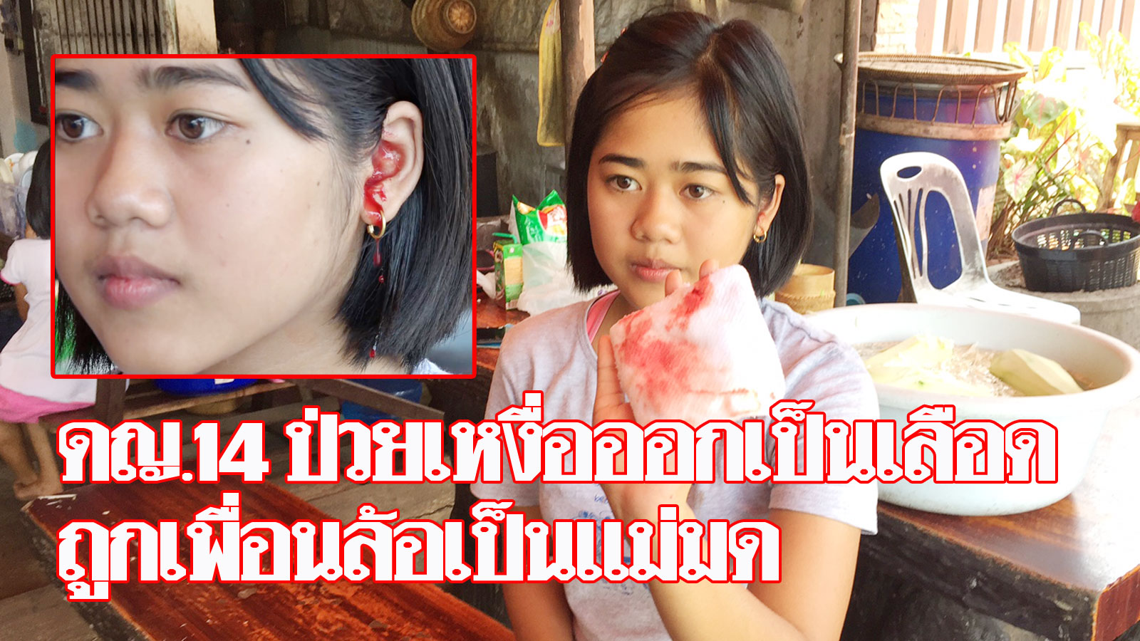 ดญ.วัย 14 ป่วยโรคประหลาด เหงื่อออกเป็นเลือด ถูกเพื่อนล้อเป็นแม่มด จน ...