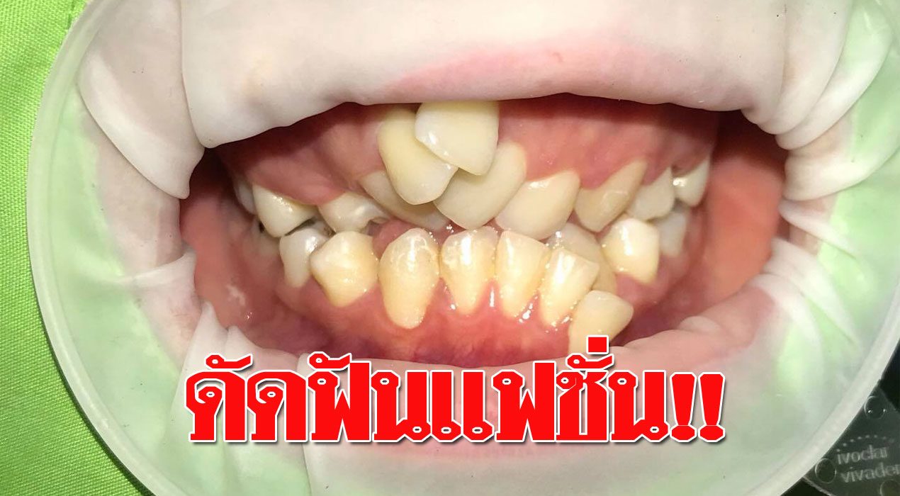 เตือนสติ เตือนสติ