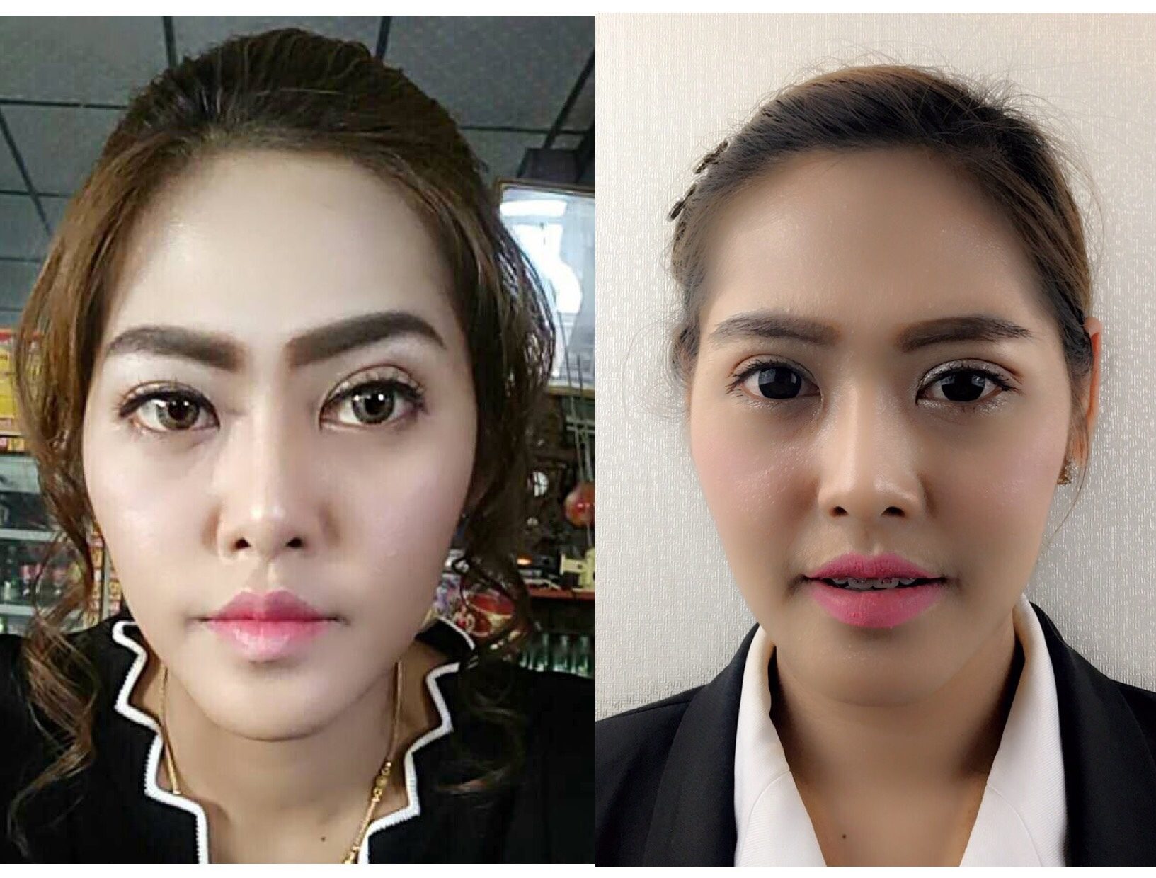 ทำตา2ชั้น