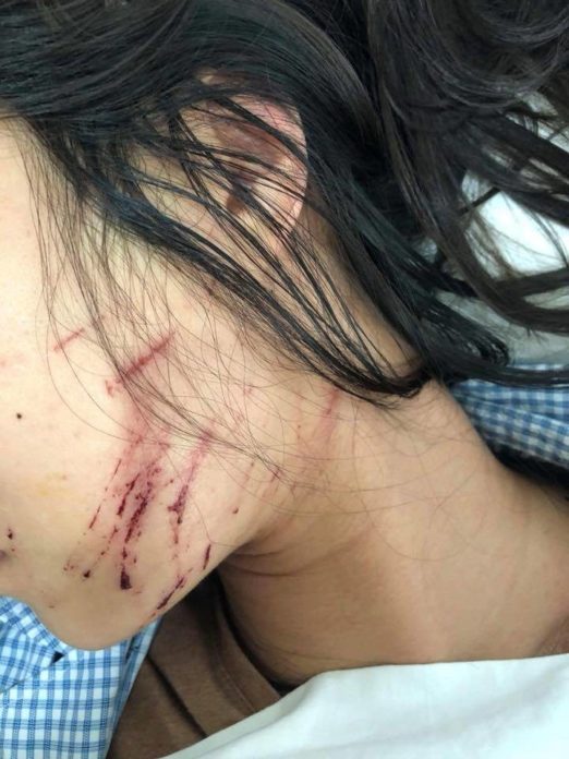 โมโหจัด เมียหลวงสุดโหด กระชากหัวเมียน้อยตบ