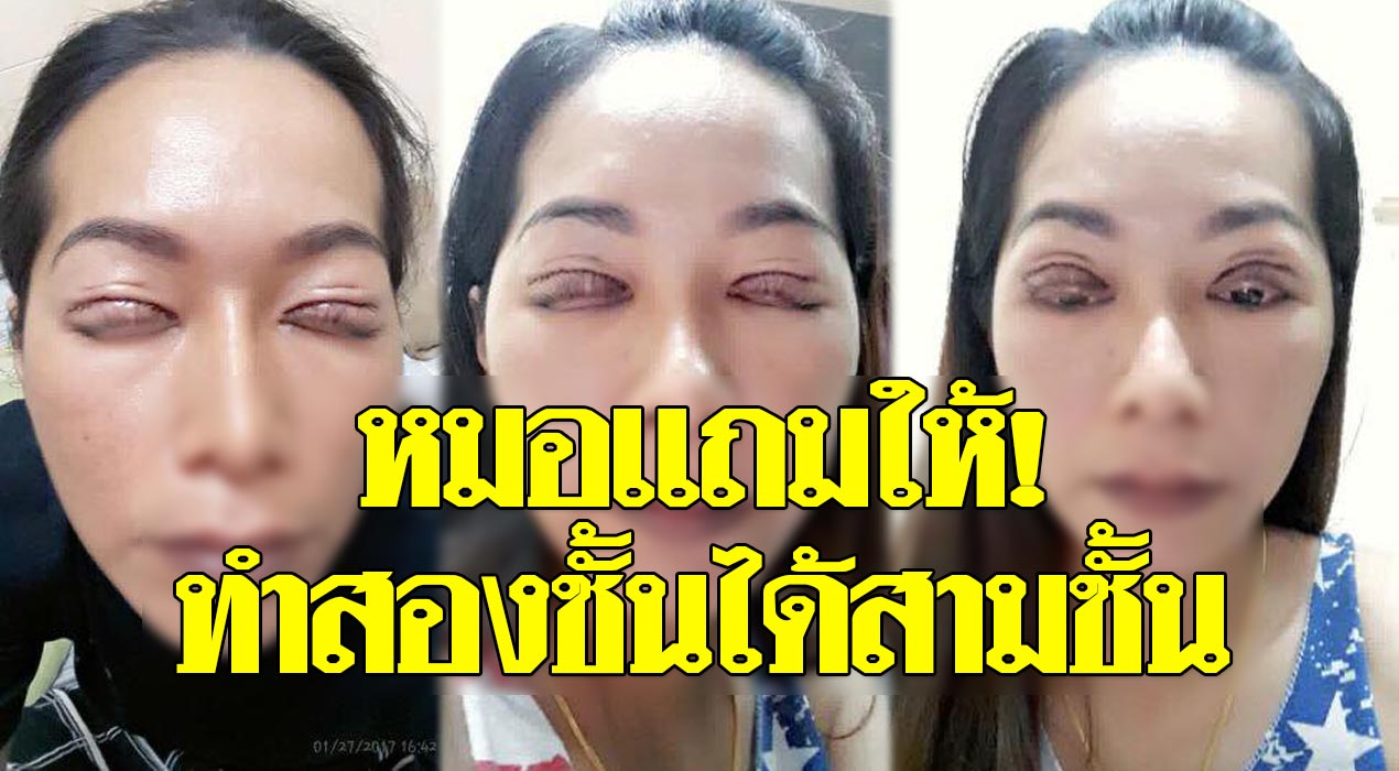 อุทาหรณ์ สาวอยากสวยกลับสยอง ทำตา 2 ชั้น ได้ตา 3 ชั้น! อุทาหรณ์ สาวอยากสวยกลับสยอง ทำตา 2 ชั้น ได้ตา 3 ชั้น!