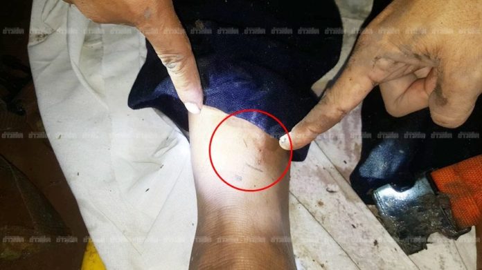 ลุงยื้อชีวิตตัวเอง