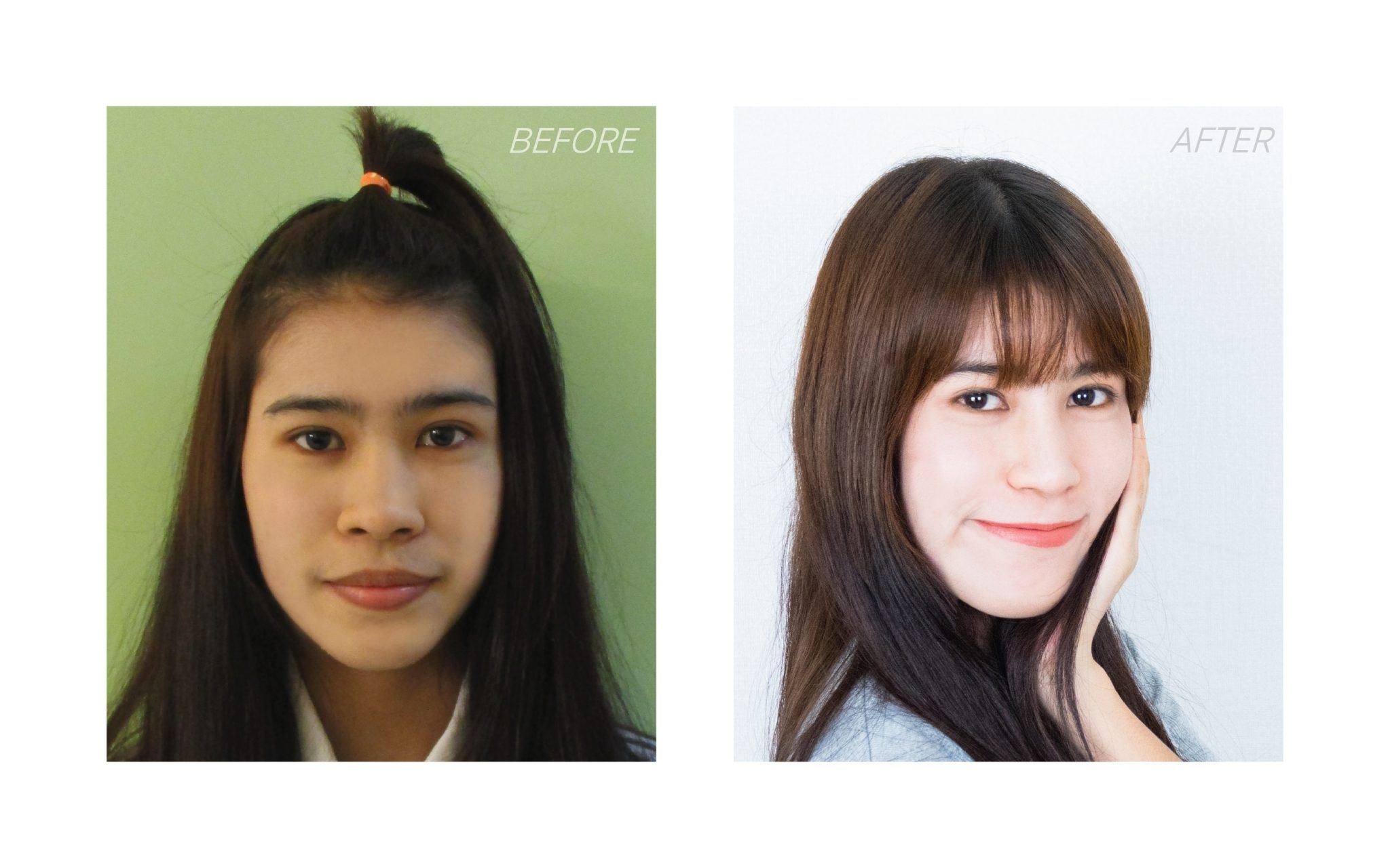 เสริมจมูก อย่างเป็นธรรมชาติ