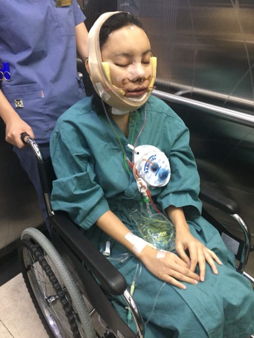 เอ็มมี่-อมลวรรณ ‘เอ็มมี่ อมลวรรณ’ ทุบหน้าใหม่ ฝันอยากเหมือน ‘ชมพู่ อารยา’