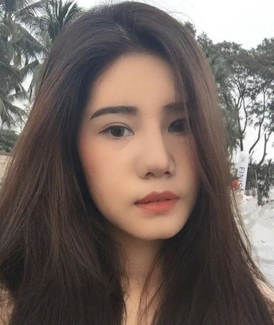 เสริมจมูก เป็นธรรมชาติ
