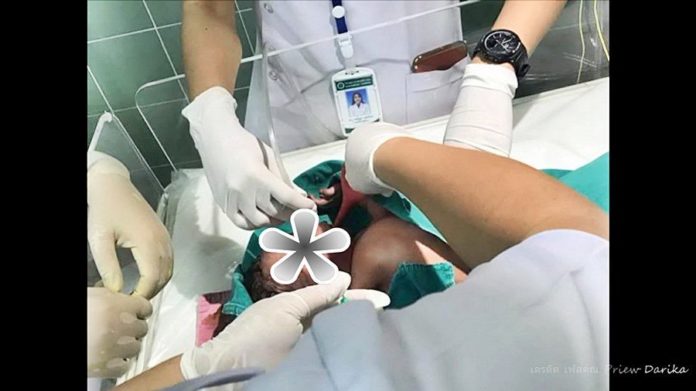 ทารกถูกทิ้งในป่า พบสายรกยังติดอยู่