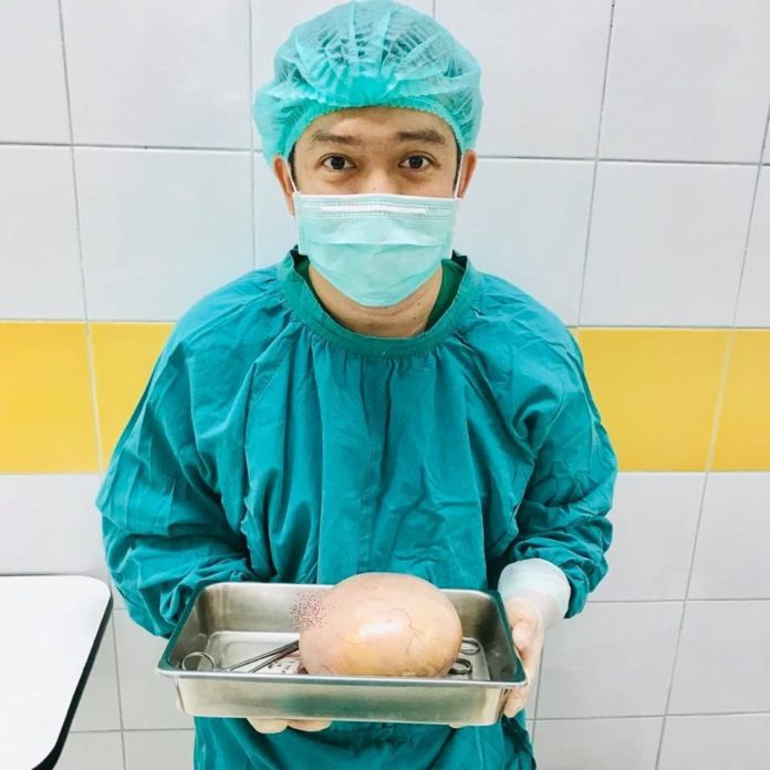 สาววัย30 ต้องระวัง "เดอร์มอยด์ซีสต์"