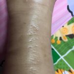 ข้องใจ เมียท้องขาบวม หายใจติดขัด หมอบอกปกติ สุดท้ายครรภ์เป็นพิษดับ ลูกเข้าไอซียู!