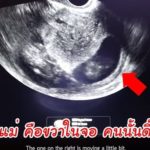 ป๊อก-มาร์กี้ พาไปดูลูกแฝด เริ่มมีแขนขา-ดิ้นเก่ง เขินหมอไขข้อสงสัยเรื่องเซ็กซ์(คลิป)