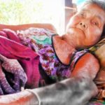 ลูกชายพอใจ รพ.หนองคาย ขอโทษ เหตุ ย่าวัย80แขนเน่าติดเชื้อ หามส่งรพ.อีกรอบ