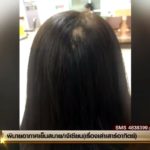 สยองประกายไฟหม้อแปลง ร่วงเผาหัว-สาวพีอาร์ จี้ไฟฟ้าดูแล-ตายมาใครรับผิดชอบ