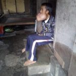 เนื้องอกล้นปาก หนุ่มบาดเจ็บขากรรไกรจากเล่นบาส ทรมานนาน7ปี