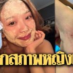 ช็อกสภาพ 'หญิงแย้' ผื่นแดงลุกลามทั่ว-สุดคัน แฟนคลับสุดเป็นห่วง