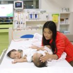 ผ่าแยกแฝดภูฏาน หมอออสซี่ระดมทีมลงมีด 6 ชั่วโมง - สำเร็จ!