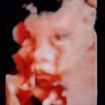 อีฟ ตั้งชื่อลูกชายล่วงหน้า น้องมีบุญ ชี้คุณหมอเชื่อศักยภาพคลอดเองได้