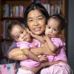 ผ่าแยกแฝดภูฏาน หมอออสซี่ระดมทีมลงมีด 6 ชั่วโมง - สำเร็จ!