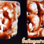 ป๊อก เฮลั่น รู้เพศ แฝดหมื่นล้าน ดีใจหนัก เห็นหน้าลูก4D มาร์กี้ แซวซื้อเครื่องอัลตร้าซาวด์(คลิป)