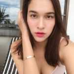 หยาดทิพย์ เข้าผ่าตัดด่วน กระดูกหัก 2 ข้าง ต้องยกเลิกงานกะทันหัน แห่ให้กำลังใจ