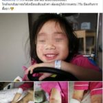 แม่โพสต์เตือน! ลูกป่วยติดเชื้อ หน้าบวม ผิวลอก เจ็บแสบทรมาน เพราะถูกคนอื่นกอด-หอม
