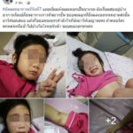 แม่โพสต์เตือน! ลูกป่วยติดเชื้อ หน้าบวม ผิวลอก เจ็บแสบทรมาน เพราะถูกคนอื่นกอด-หอม