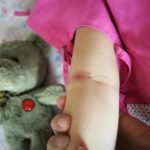 แม่โพสต์เตือน! ลูกป่วยติดเชื้อ หน้าบวม ผิวลอก เจ็บแสบทรมาน เพราะถูกคนอื่นกอด-หอม