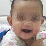 ลูกน้อยป่วย หนังลอกทั่วตัว ร้องเจ็บทุรน แม่ใจจะขาด จำจนตาย อย่าให้ใครหอม-อุ้ม