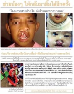 ปากกระจับ
