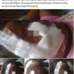แม่โวย! ลูกสาว 5 ขวบ โดนหมาขย้ำ หน้าเหวอะ ตาหวิดบอด เจ้าของจ่าย 1 พัน ค่าทำขวัญ