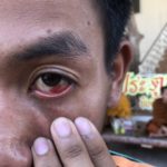 เปิดใจนศ. ถูก6ตร.บุกห้องกระทืบ บังคับให้รับขายยาบ้า ไม่เจอบอก "ผิดคนขอโทษ"