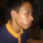 โวย ตร. บุกห้องรุมซ้อม นศ.หนุ่ม เท้าเหยียบหน้า บังคับให้สารภาพค้ายา