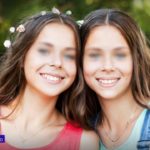หมอเร่งช่วยชีวิต นางแบบสาวฝาแฝดวัย 14 ป่วยอะนอเร็กเซียขั้นรุนแรง
