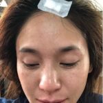 หวิดเสียโฉม! จิ๊บ ปกฉัตร เลือดอาบคารถตู้ เร่งนำตัวส่งรพ.กันวุ่น
