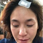 หวิดเสียโฉม! "จิ๊บ ปกฉัตร" หัวแตกเลือดอาบ เย็บถึง 7 เข็ม แถมทิ้งท้ายเผื่อนักเสี่ยงโชค