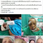 ทอม หึงโหด ง้อสาวหมอนวด ไม่สำเร็จ กระทืบโคม่า! เข้าไอซียู ทำเสียโฉม-ปากแหว่ง