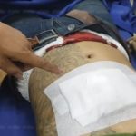 ฉลองวันเกิด ดับสลด! หนุ่มโดนตาม ประกบยิงจมเลือด หน้าร้านโอเกะ เพื่อนสุดยื้อ