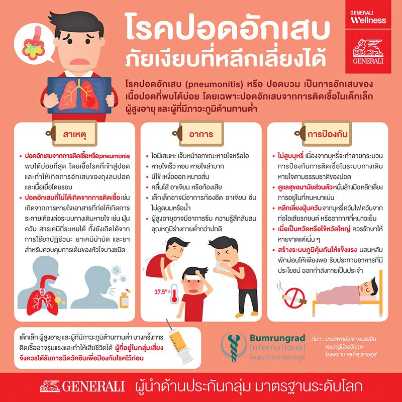 ปอดอักเสบ