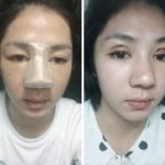 เปิดภาพล่าสุด! เคโงะ "ซากุระ" ซาโต ศัลยกรรมหน้าใหม่ อยากสวยเหมือน "โยชิ"