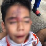 สายเคเบิ้ลร่วงกลาง สี่แยก สองพ่อลูกเคราะห์ร้าย หัวน็อกฟาดพื้น-ตาหวิดบอด ระทึก!