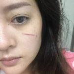 หวิดเสียโฉม! ดาราสาว แก้มบุ๋ม เลือดอาบหน้า โดนเข้าเต็มๆ แฟนคลับตกใจ
