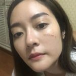 หวิดเสียโฉม! ดาราสาว แก้มบุ๋ม เลือดอาบหน้า โดนเข้าเต็มๆ แฟนคลับตกใจ