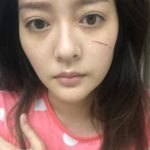 หวิดเสียโฉม! ดาราสาว แก้มบุ๋ม เลือดอาบหน้า โดนเข้าเต็มๆ แฟนคลับตกใจ