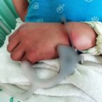 แม่รับมือไม่ไหว! ลูกชายวัย16 คลั่งขาดยา ทำร้ายร่างกาย ตร.จับใส่กุญแจมือ ดิ้นจนแขนบวม