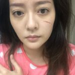 แก้มบุ๋ม โดนแมวข่วนหน้า หวิดเสียโฉม วาเลนไทน์ไม่เหงา มีหนุ่มคุย