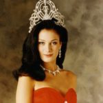 มิสยูนิเวิร์ส1993 ไม่ทันสังเกตไฝ ลามเป็นมะเร็งผิวหนัง ชี้เป็นอุทาหรณ์