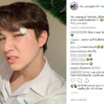 หมอริท เดอะสตาร์ โพสต์ ไม่น่าเลย เลือดท่วม - จียอน ถามเจ็บมากมั้ยคะ!!