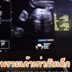 ป๊อก พา มาร์กี้-น้องแฝดหาหมอ ใกล้เจอพ่อแม่ - ตามไปดูจอดรถเซ็นทรัล มีที่ VIP มั้ย(คลิป)