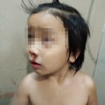 วิกฤตหนักแล้ว! พ่อโพสต์ลูก 4 ขวบ เลือดกำเดาไหล ฝุ่นพิษเชียงใหม่ ทำลายชีวิต