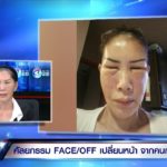 เห็นนักร้องดังทำแล้วดี! สาวปล่อยโฮทำสวยพ่นพิษ จ่ายครึ่งล้านได้หน้าผี